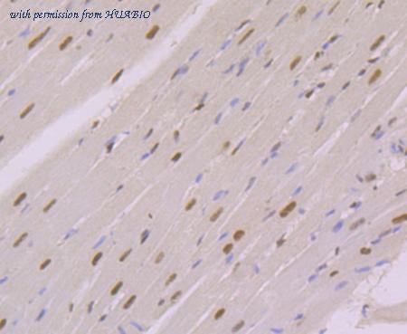 HUABIO EM1701-68 image 2