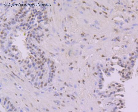 HUABIO EM1701-68 image 3