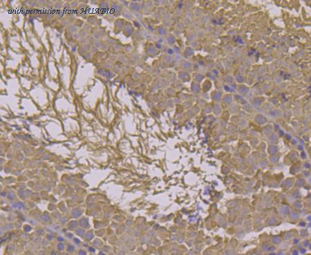 HUABIO EM1701-78 image 3