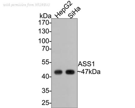 HUABIO EM1701-87 image 1