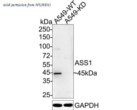 HUABIO EM1701-87 image 2