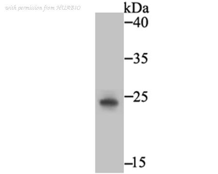 HUABIO EM1701-90 image 1