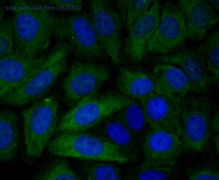 HUABIO EM1701-90 image 2