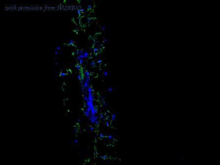 HUABIO EM1701-93 image 2