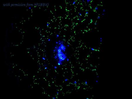 HUABIO EM1701-93 image 3