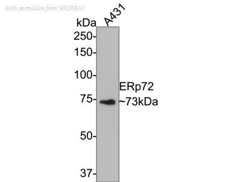 HUABIO EM1701-95 image 1
