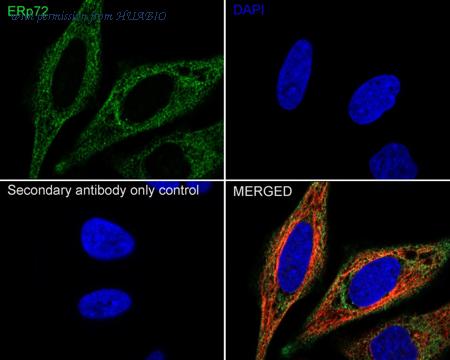 HUABIO EM1701-95 image 2