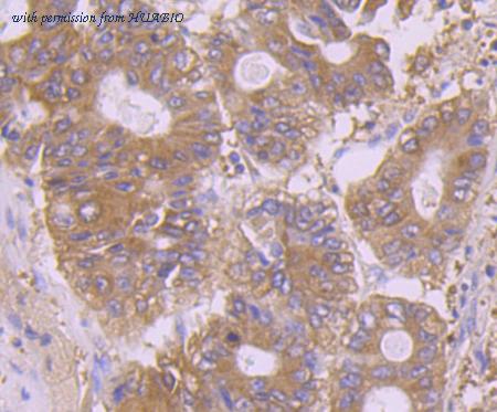 HUABIO EM1801-02 image 2