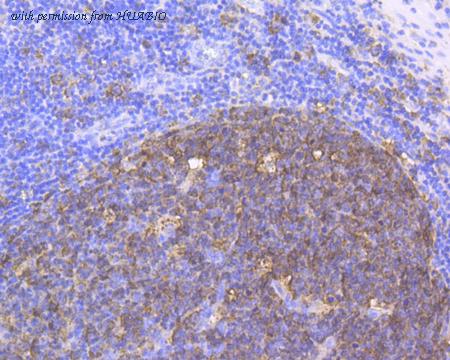 HUABIO EM1801-19 image 1