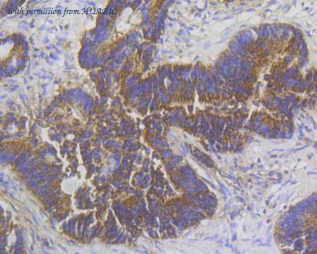 HUABIO EM1801-19 image 2