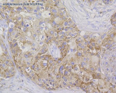 HUABIO EM1801-19 image 3