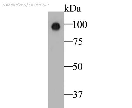 HUABIO EM1901-06 image 1