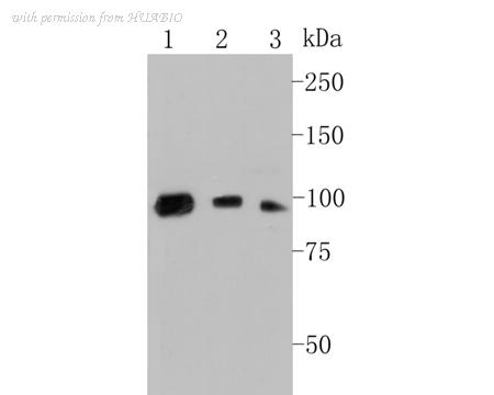 HUABIO EM1901-14 image 1