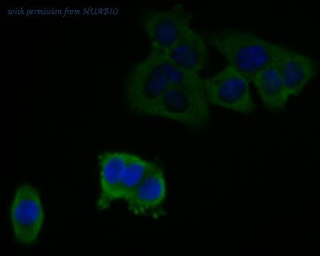 HUABIO EM1901-14 image 3