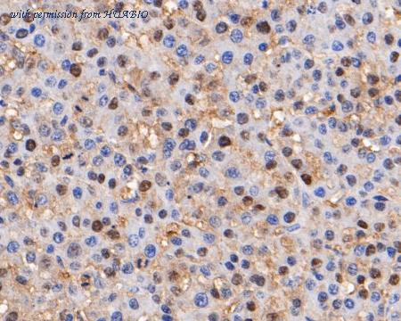 HUABIO EM1901-22 image 2