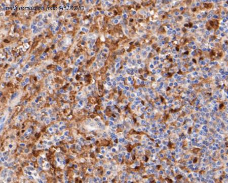 HUABIO EM1901-22 image 3