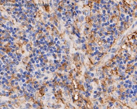 HUABIO EM1901-23 image 3