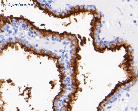 HUABIO EM1901-25 image 2