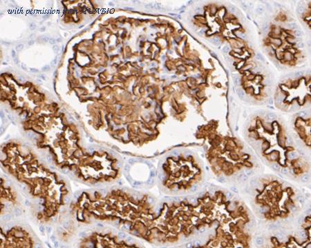 HUABIO EM1901-25 image 3