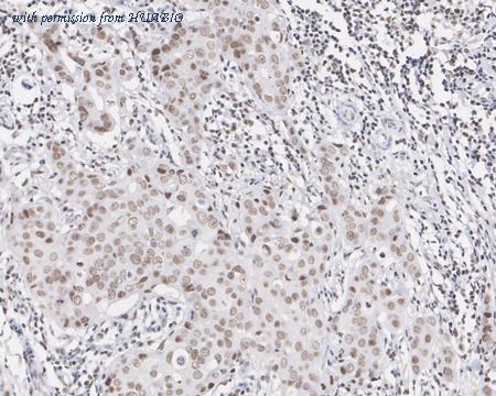 HUABIO EM1901-34 image 2