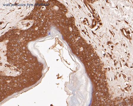 HUABIO EM1901-35 image 3