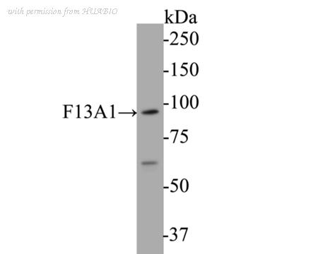 HUABIO EM1901-38 image 1