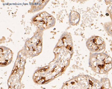 HUABIO EM1901-38 image 2