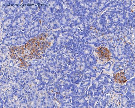 HUABIO EM1901-45 image 3