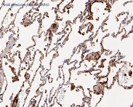 HUABIO EM1901-64 image 3