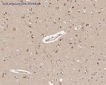 HUABIO EM1901-65 image 2