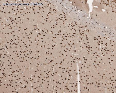 HUABIO EM1901-65 image 3