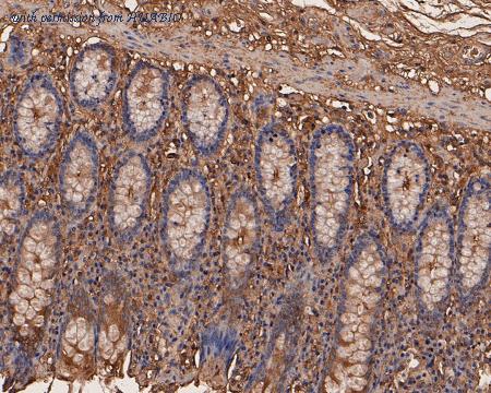 HUABIO EM1901-69 image 3