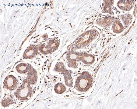 HUABIO EM1901-72 image 2