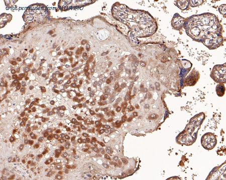 HUABIO EM1901-72 image 3