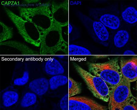 HUABIO EM1901-82 image 2