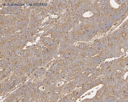 HUABIO EM1901-82 image 3