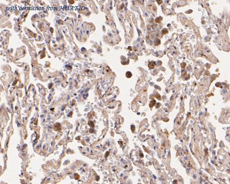 HUABIO EM1901-90 image 2