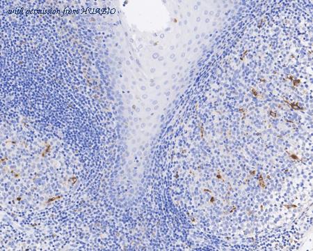 HUABIO EM1901-93 image 2