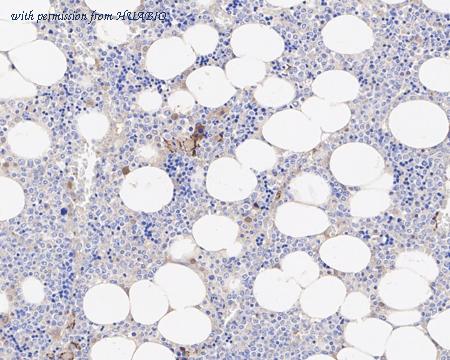 HUABIO EM1902-15 image 2