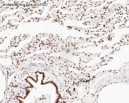 HUABIO EM1902-17 image 3