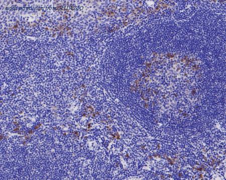 HUABIO EM1902-31 image 2