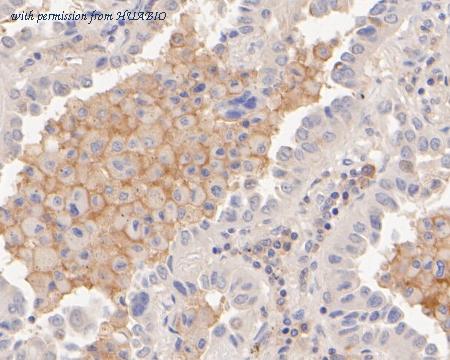 HUABIO EM1902-37 image 3