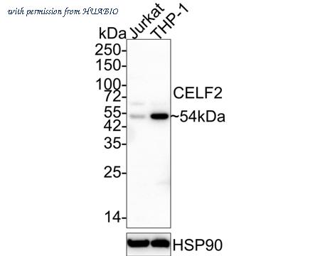 HUABIO EM1902-43 image 1