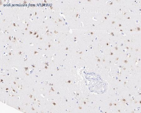 HUABIO EM1902-43 image 3