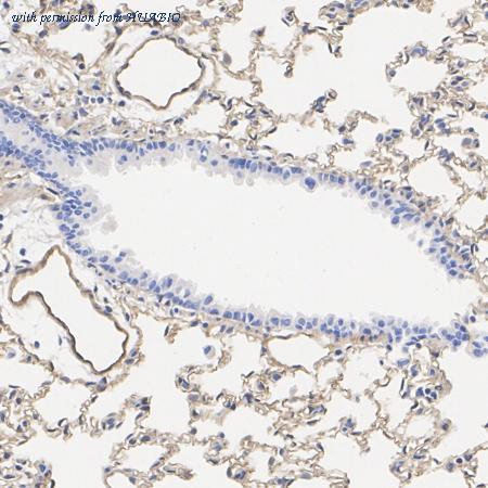 HUABIO EM40728 image 3