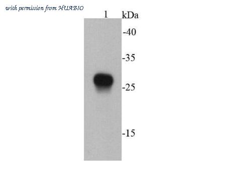 HUABIO EM50104 image 1