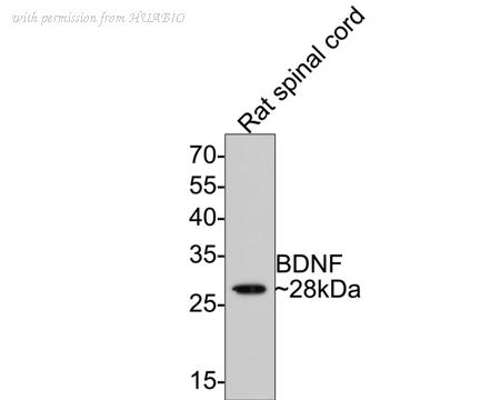 HUABIO ER130915 image 2