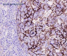 HUABIO ER131207 image 3