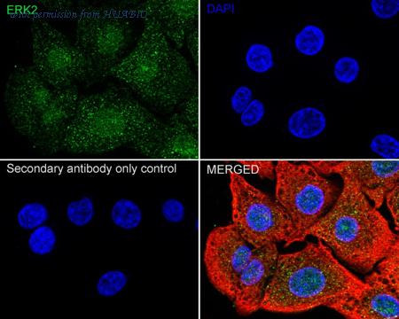HUABIO ER131218 image 3