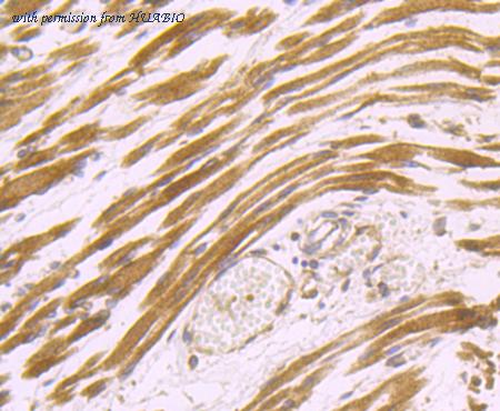 HUABIO ER1511-12 image 3